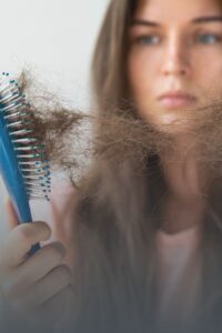 saç dökülmesi, saçsızlık, 