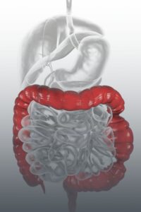 gıda hassasiyeti, gıda intoleransı, irritabl bağırsak sendromu