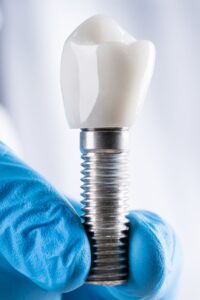 implant, zigomatik implant