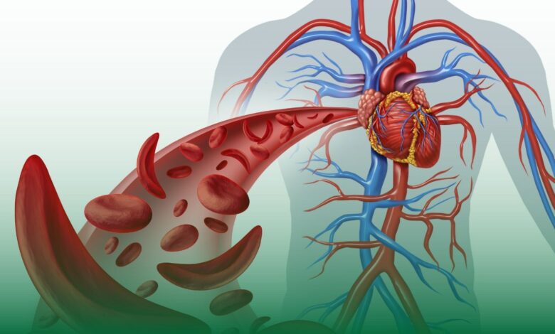 aort damarı, aort yırtılması, aort, aort diseksiyonu