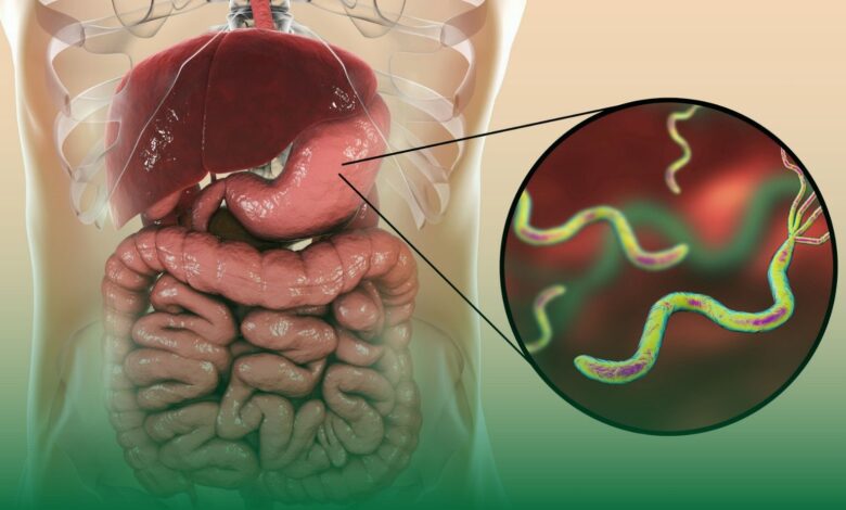helicobacter pylori,