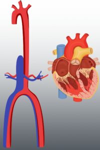 aort damarı, aort yırtılması, kalp, aort diseksiyonu