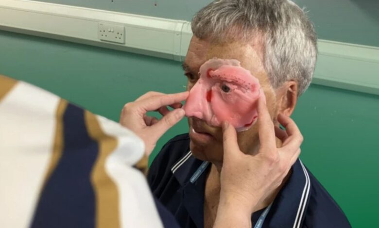 3 boyutlu yazıcı, yüz, dave richards, kaza, bisikletçi, yüz nakli