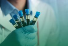 altın kan, ispanya,