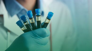 altın kan, ispanya,