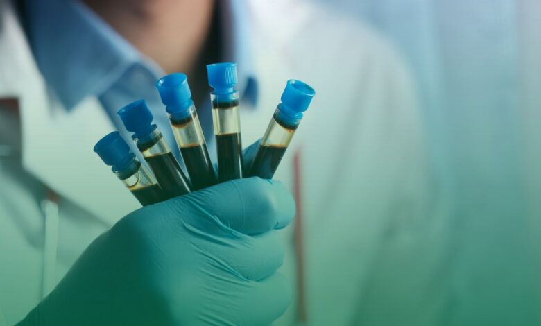 altın kan, ispanya,