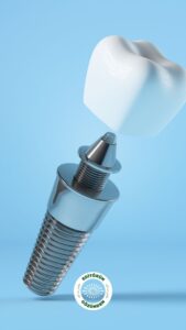 implant teknolojisi,