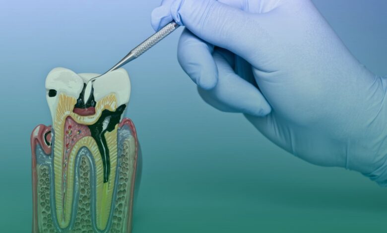 diş minesi, jel, araştırma,