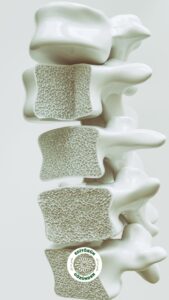 osteoporoz, erken menapoz,