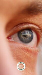 renk, solma, belirti, hastalık,