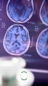 alzheimer, belirti, sağlık,