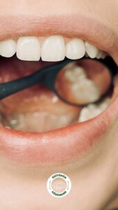 ağız, şeker, diş sağlığı,