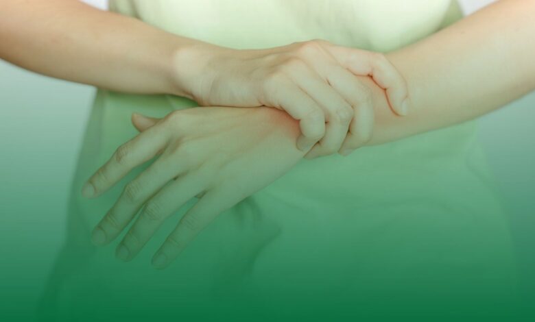 Romatoid Artrit, eklem ağrısı, kış ayı,