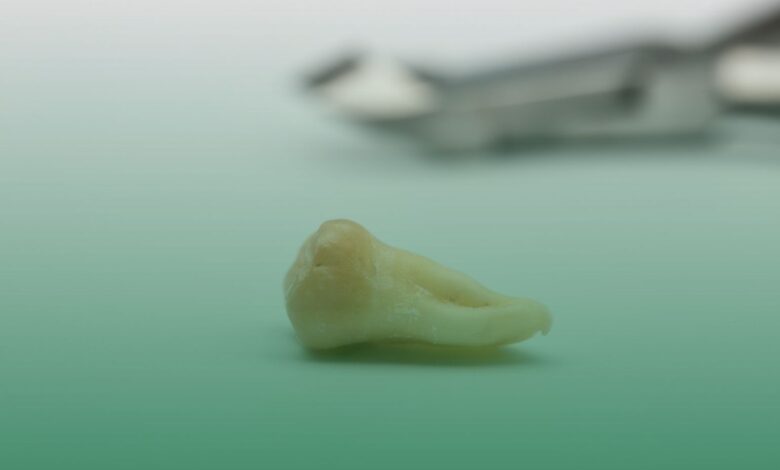 diş kaybı, hafıza, araştırma,