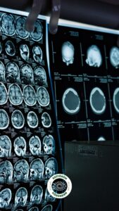 menopoz, beyin, değişiklik,