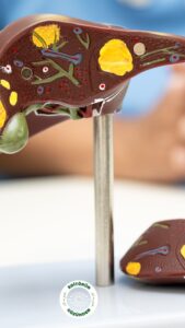 karaciğer, yağlanma, kanser,