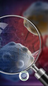 kan testi, umut, kanser, pankreas,