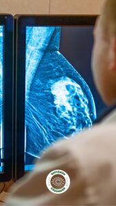 yapay zeka, meme kanseri,