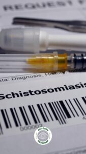 Şistozomiyaz, parazit,