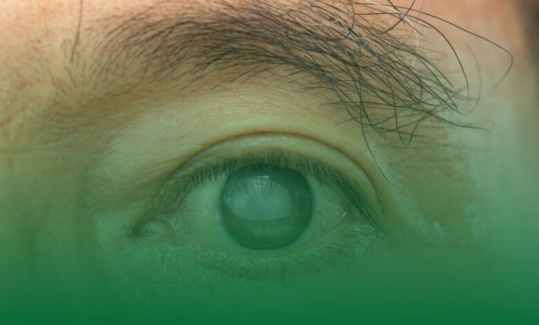 glokom, ramazan, göz sağlığı,