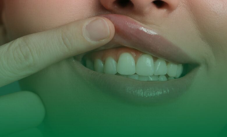 diş eti, kanama, kalp krizi,