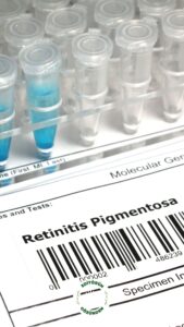 Retinitis Pigmentosa, çocuk,