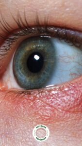 kornea, balık pulu,