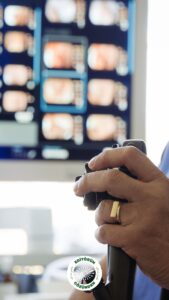 pangastrit, endoskopi,