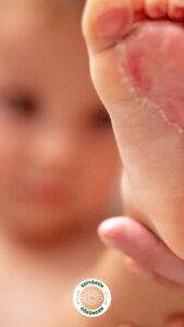 el ayak ağız, çocuk,