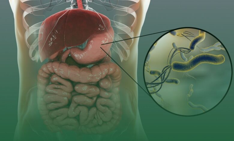 Helicobacter pylori, mide yanması,