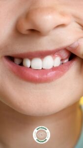 TİP 1 DİYABETLİ ÇOCUKLARDA AĞIZ SAĞLIĞI